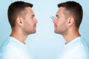 Liposuction In Bristol